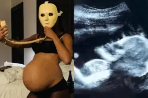 Gravidez fake de Anitta