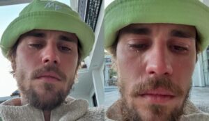 Justin Bieber preocupa fãs (redes sociais)