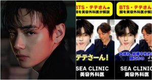 Cirurgião elogia beleza de V, do BTS