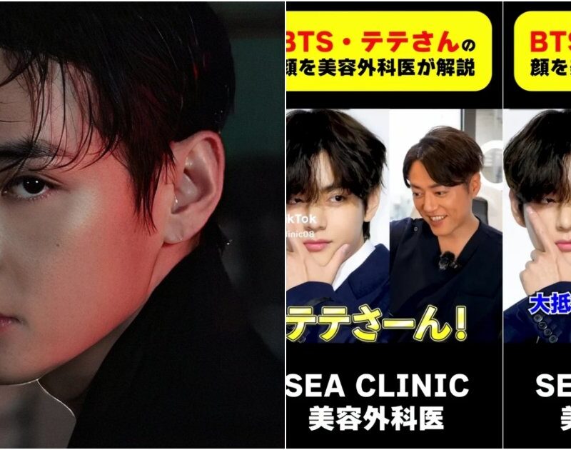 BTS: V é chamado de ‘tesouro nacional da beleza’ por cirurgião plástico