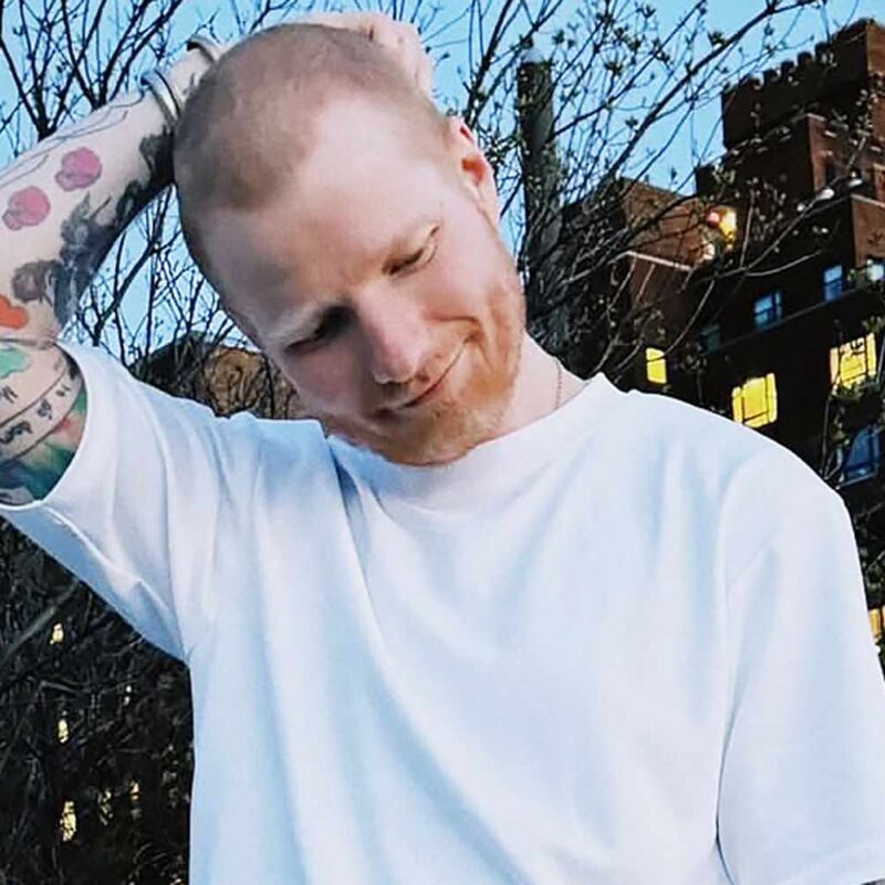 Ed Sheeran raspa a cabeça e revela doença às vésperas de turnê